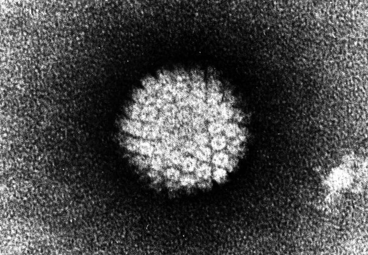 Wirus brodawczaka ludzkiego, który powoduje zmiany skórne